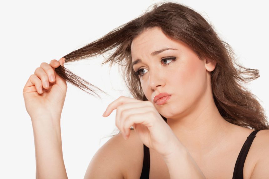 Kadınlarda Erkek Tipi Saç Dökülmesi